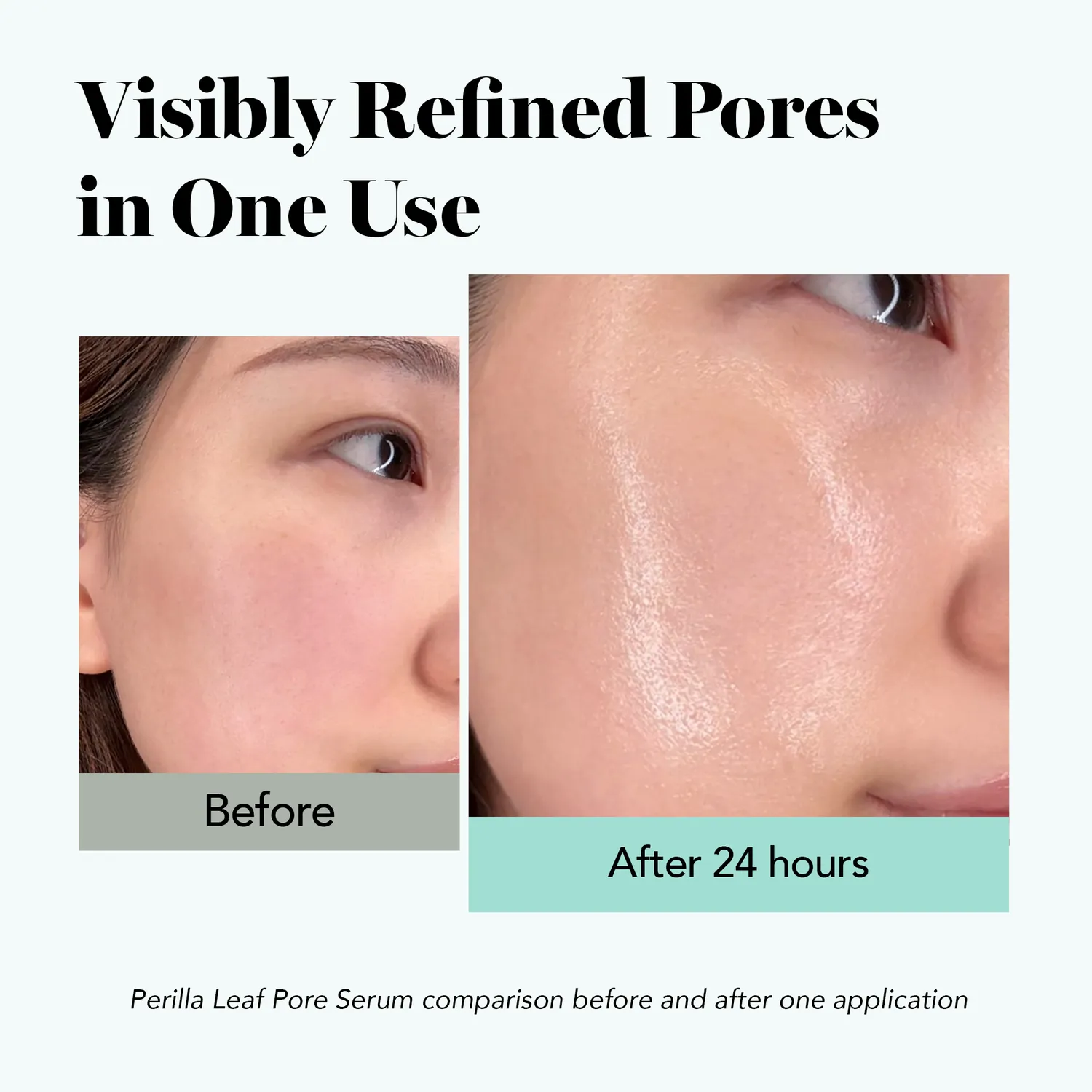 Saturday Skin Perilla Leaf Pore Refining serum mod porer og fedtet hud