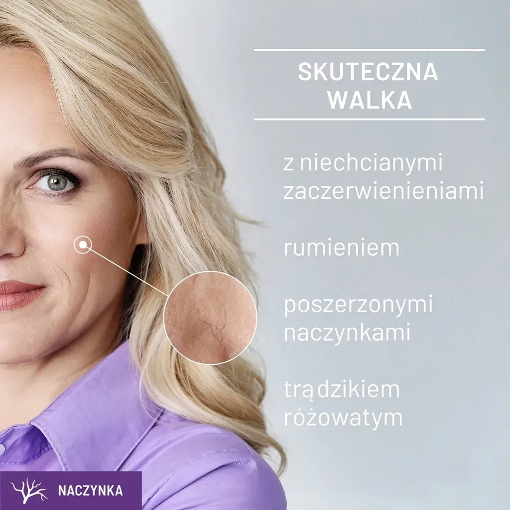 Sylveco Dermo Beroligende micellevand til rødme