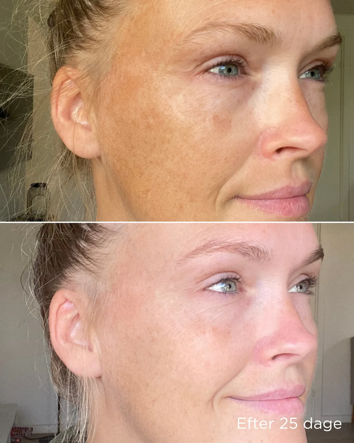 Ecooking Pigment Trio sæt mod pigmentpletter