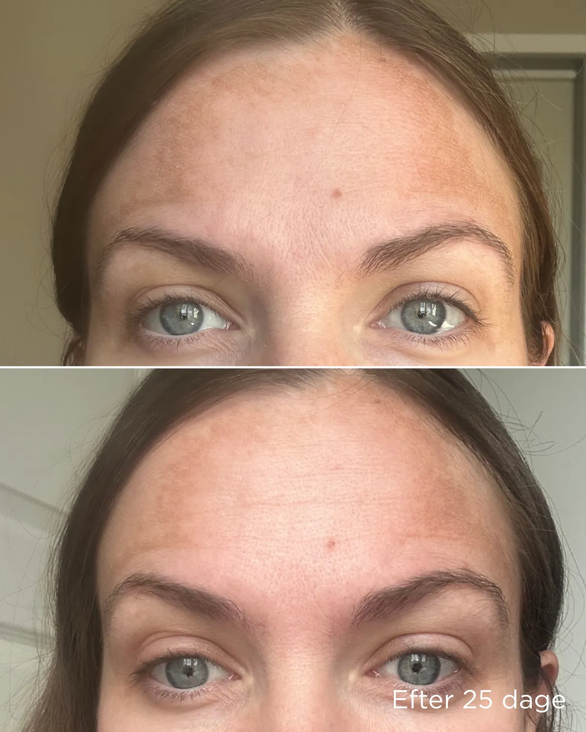 Ecooking Pigment Trio sæt mod pigmentpletter