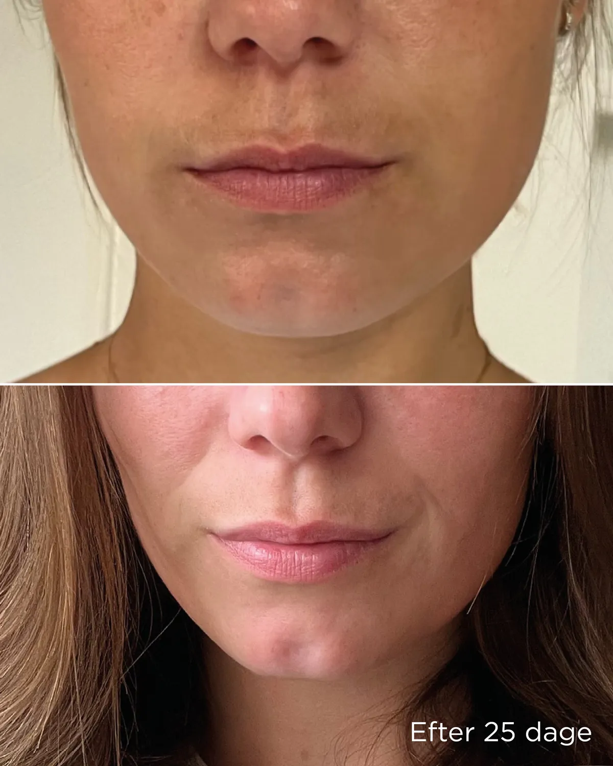 Ecooking Pigment Trio sæt mod pigmentpletter