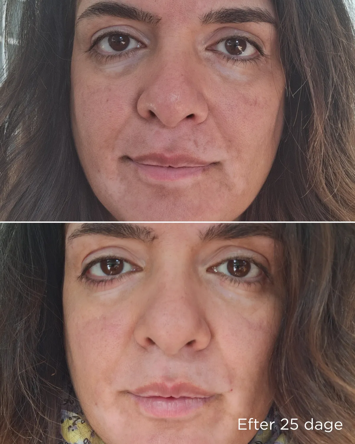 Ecooking Pigment Trio sæt mod pigmentpletter