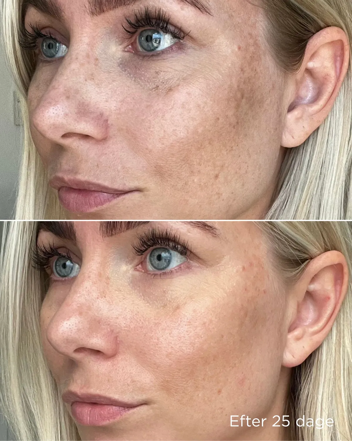 Ecooking Pigment Trio sæt mod pigmentpletter